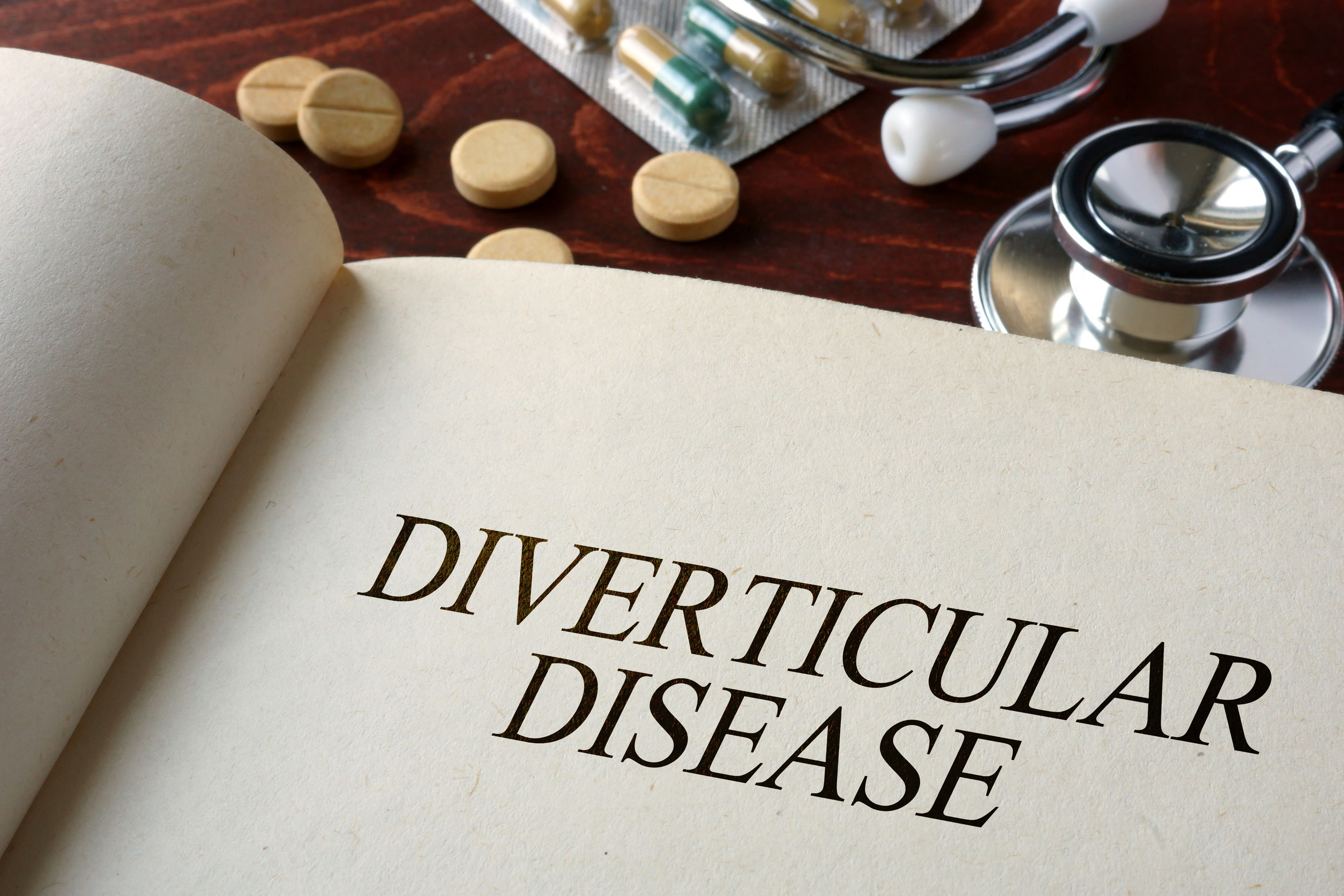 diverticulitus