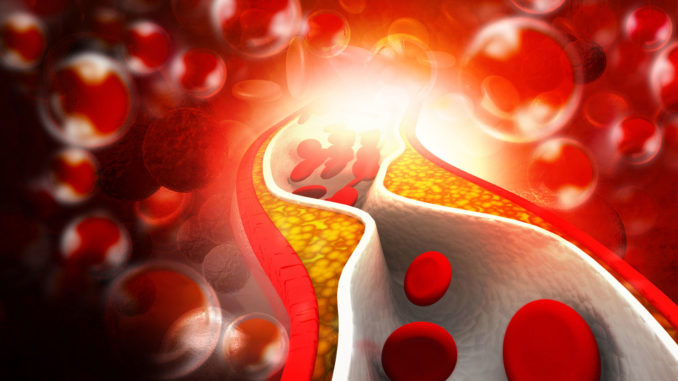 cholesterol
