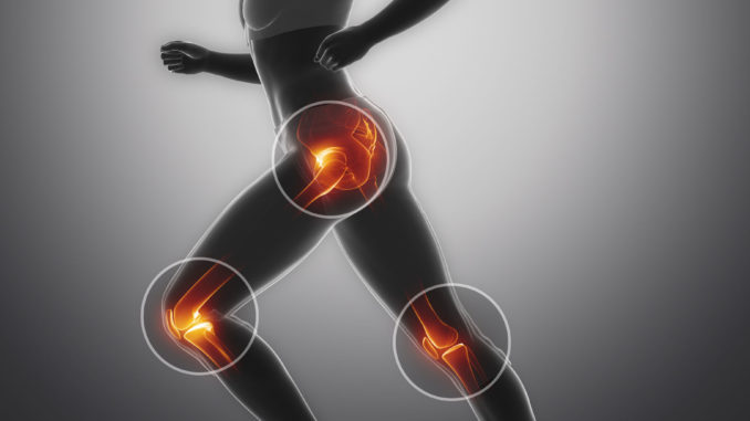 arthritis