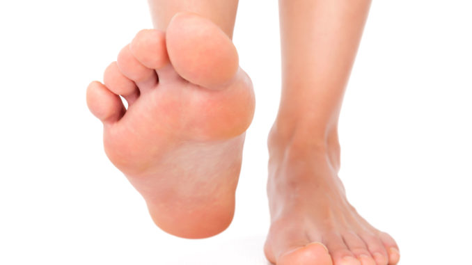 flatfoot