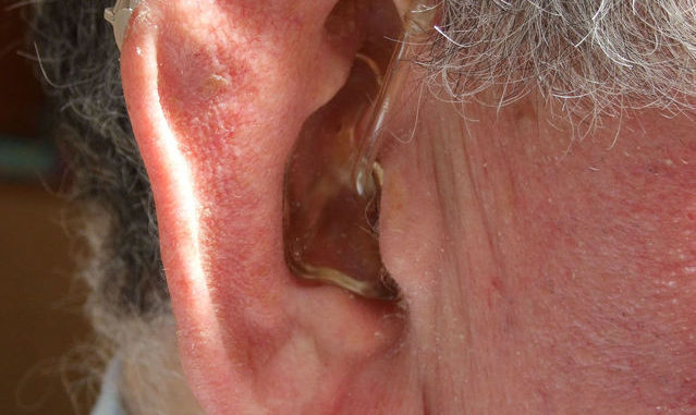 hearing-impaired-1307604-639x852