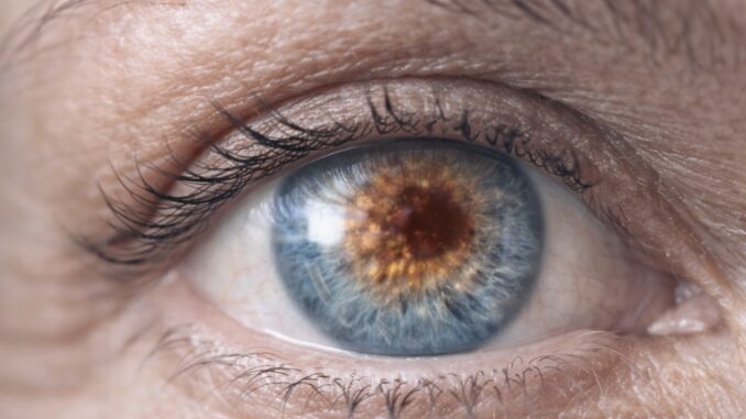 Close-up photo of an older adult’s eye illustrating age-related macular degeneration and changes in central vision.
