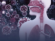 3D medical illustration of the human respiratory system with virus particles floating nearby, illustrating how infections can affect the body and contribute to cancer.